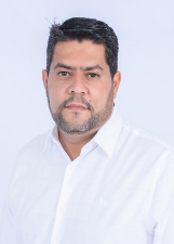 Foto oficial de Johny Albino